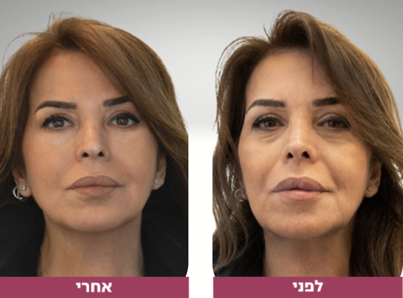 Pictures before and after