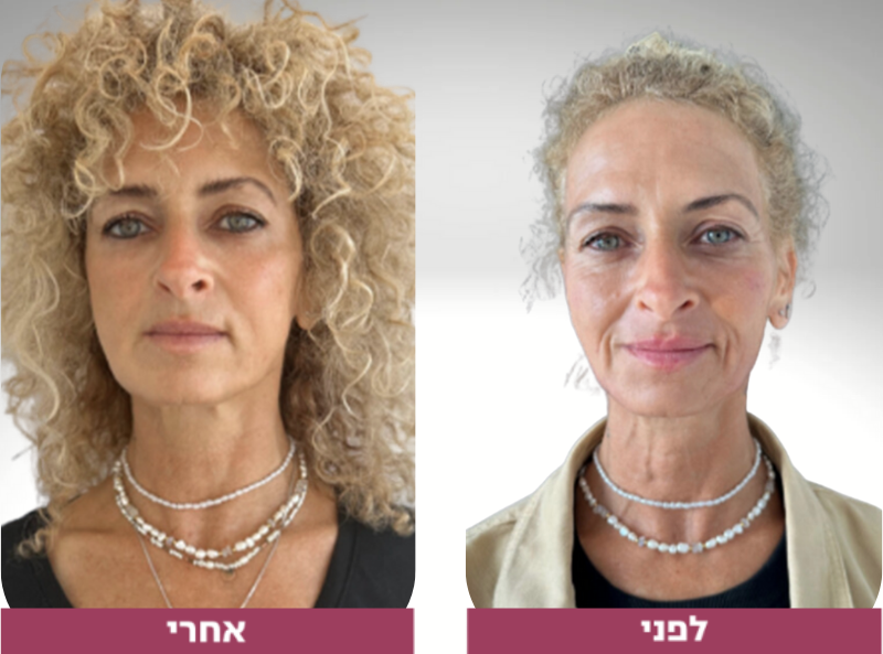 Pictures before and after