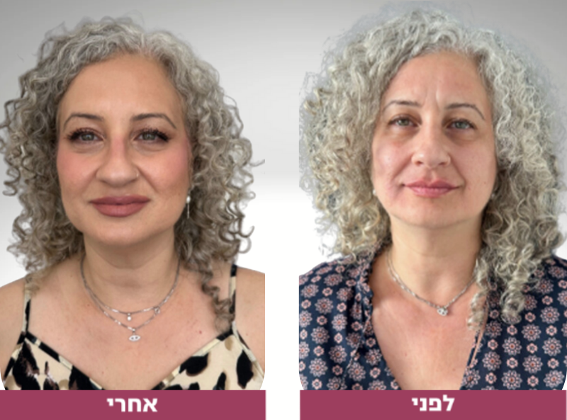 Pictures before and after