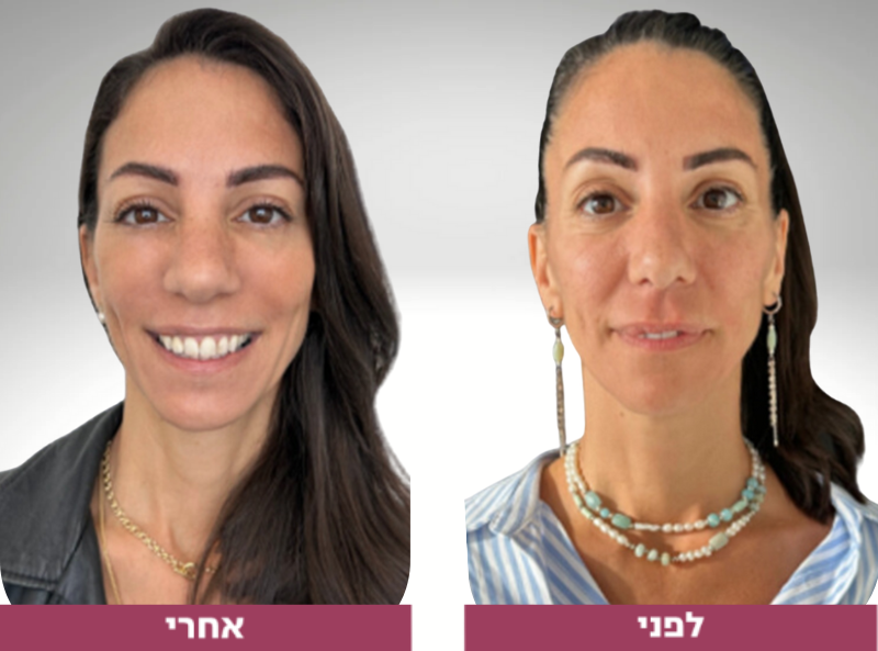 Pictures before and after