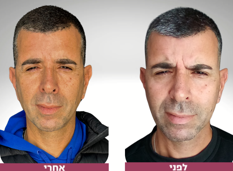 Pictures before and after