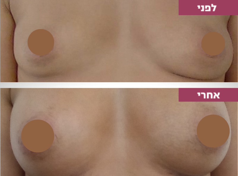 Pictures before and after