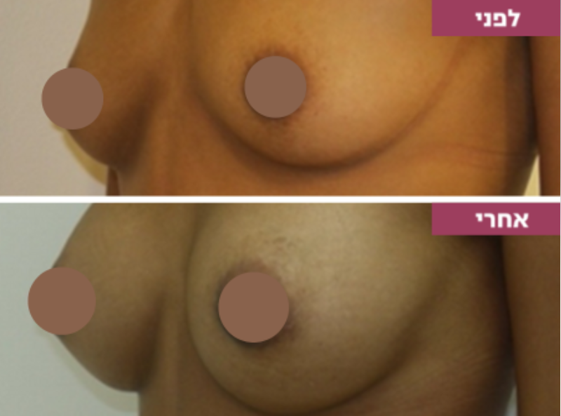 Pictures before and after