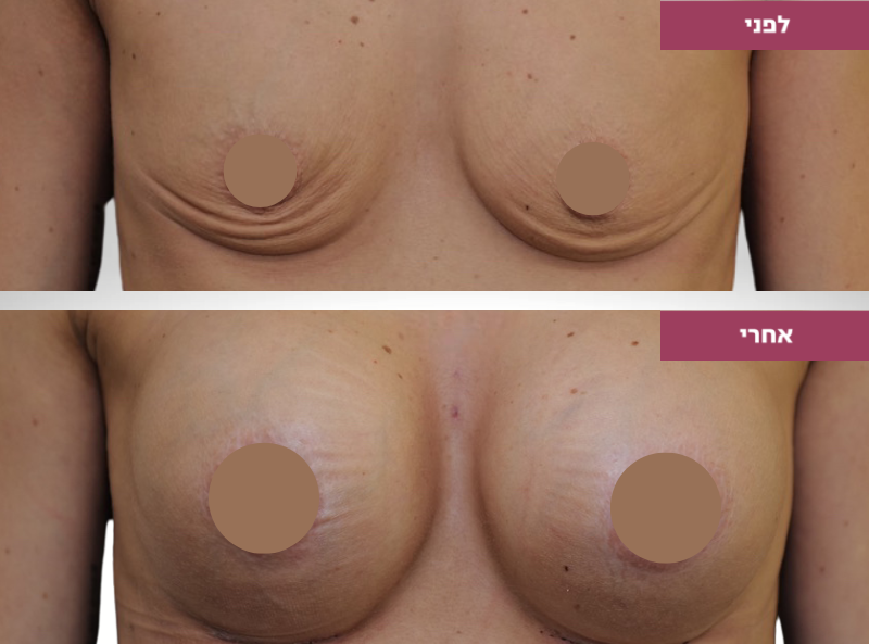 Pictures before and after