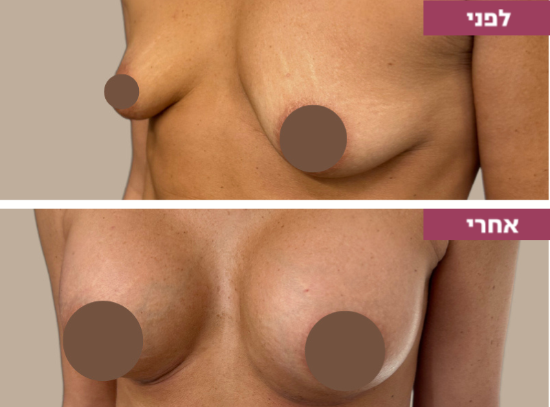 Pictures before and after