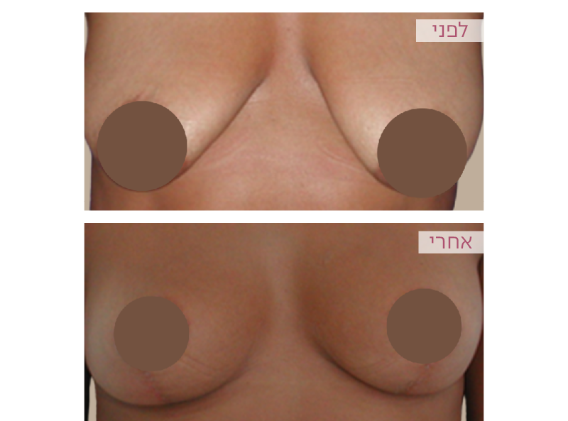 Pictures before and after
