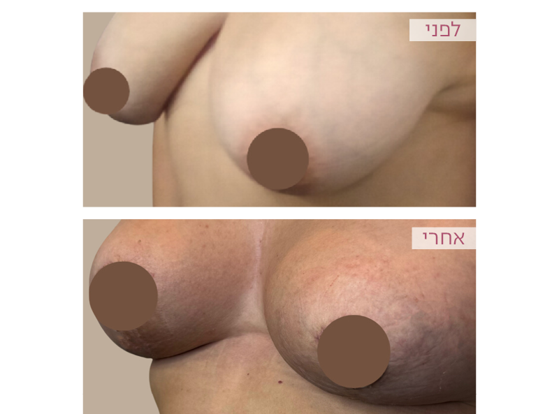 Pictures before and after