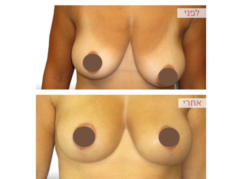 Pictures before and after