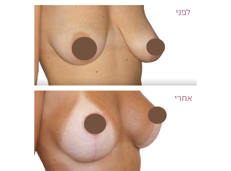 Pictures before and after