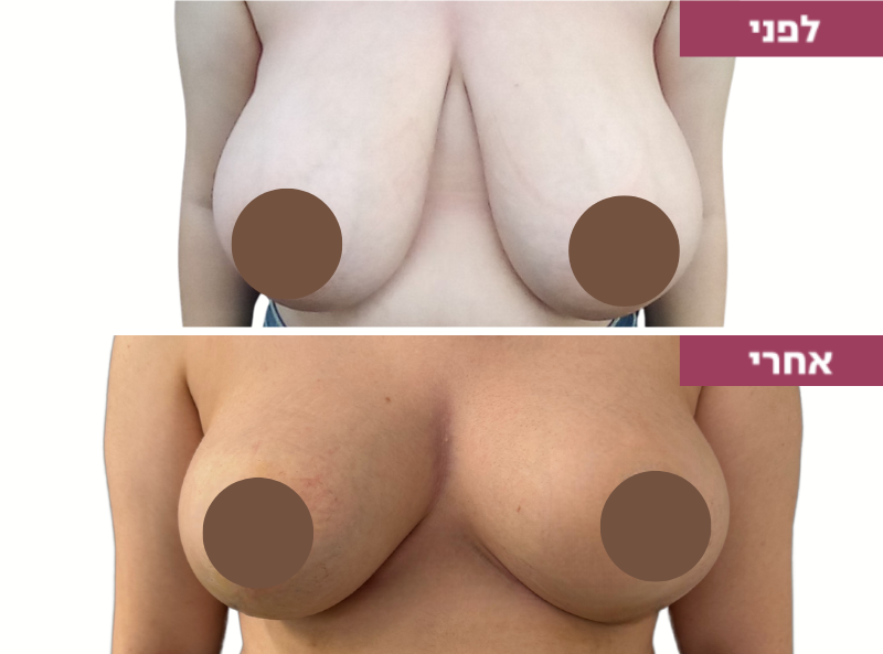 Pictures before and after