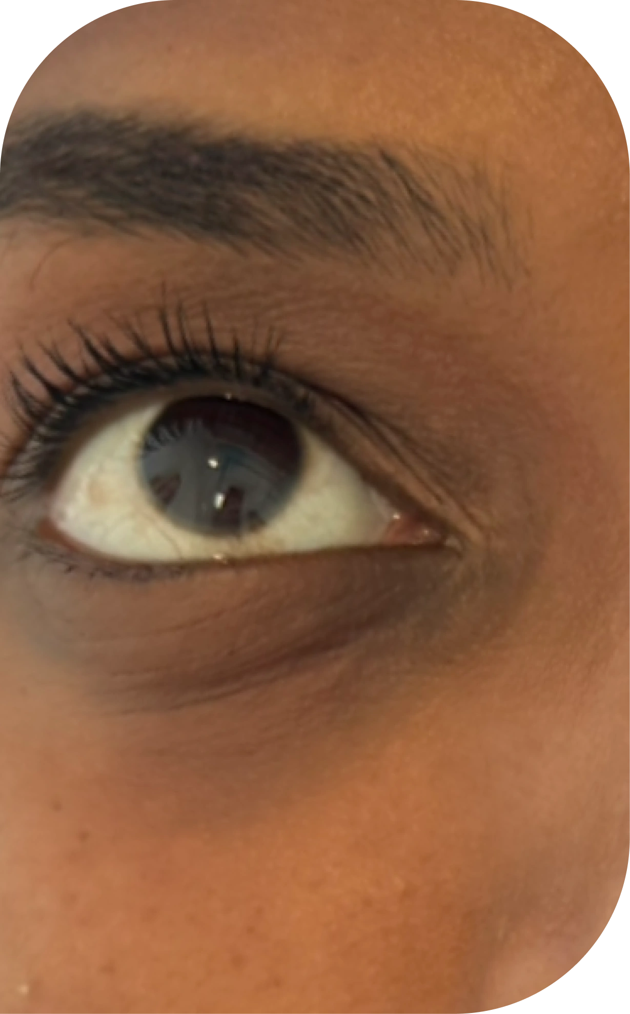 Pictures after