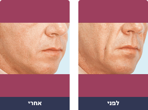 Pictures before and after