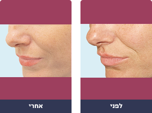 Pictures before and after