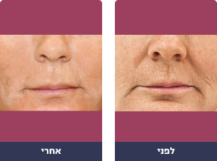 Pictures before and after