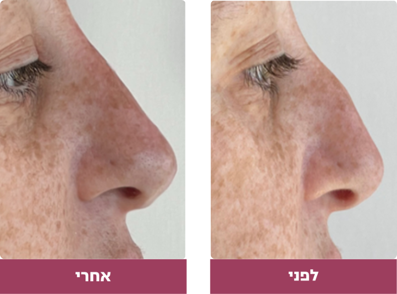 Pictures before and after