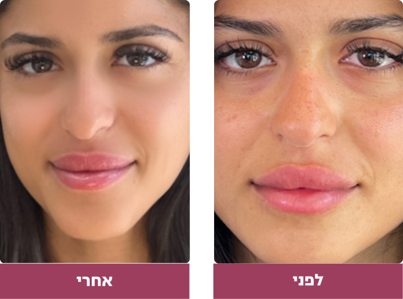 Pictures before and after