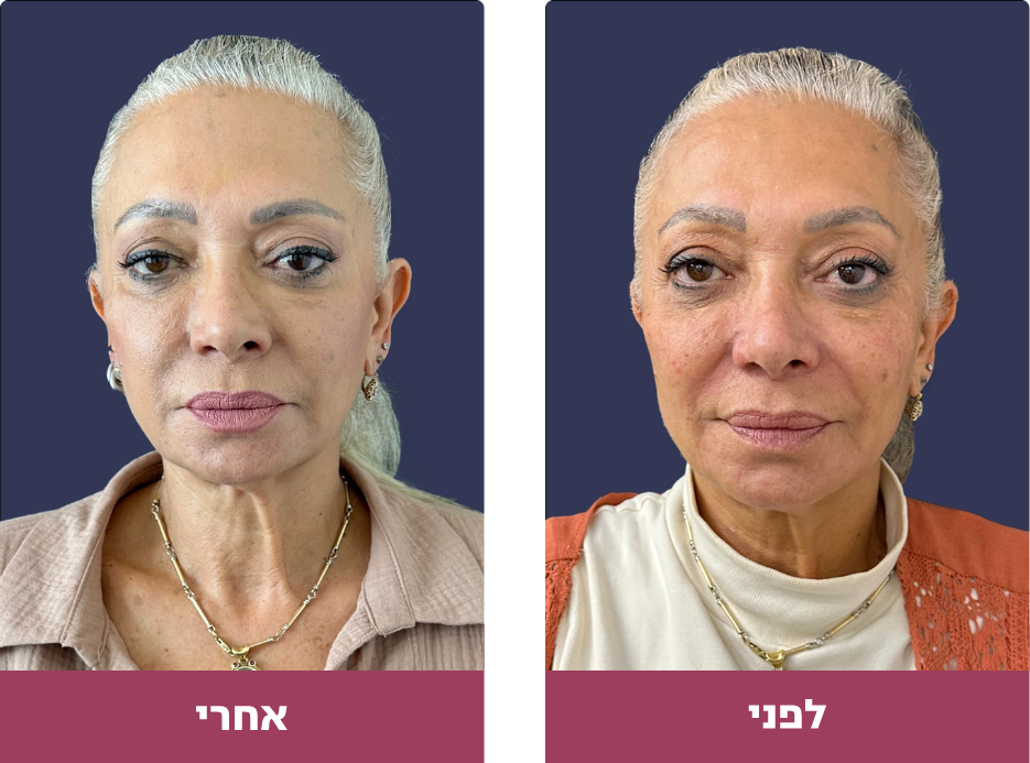 Pictures before and after