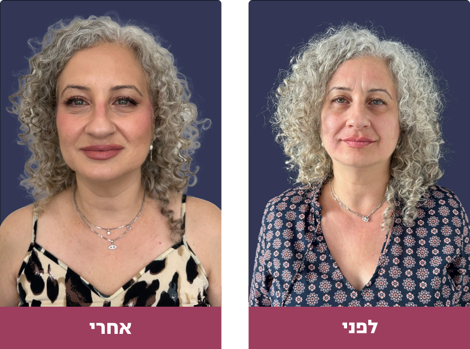 Pictures before and after