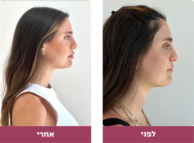 Pictures before and after