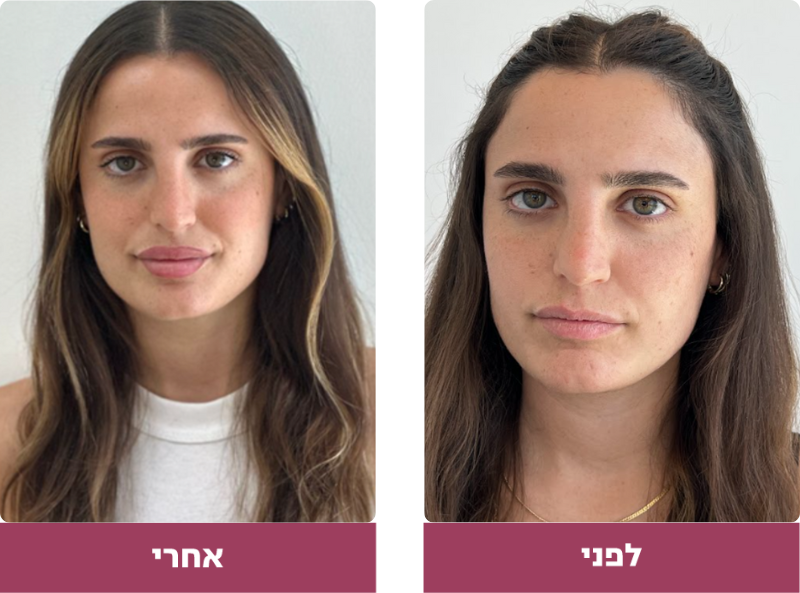 Pictures before and after