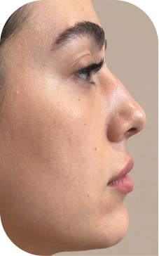 Pictures before