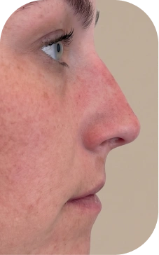 Pictures after
