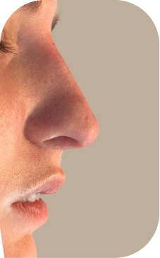 Pictures after