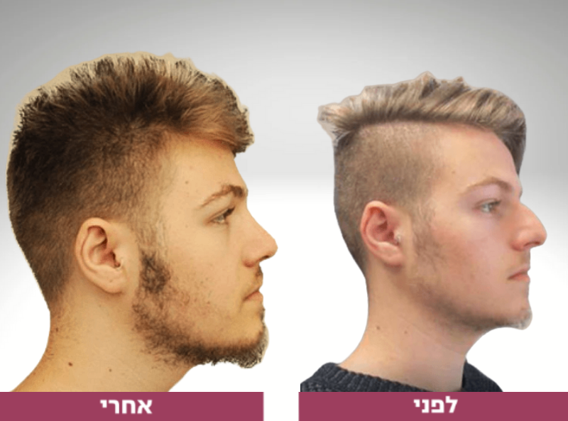 Pictures before and after