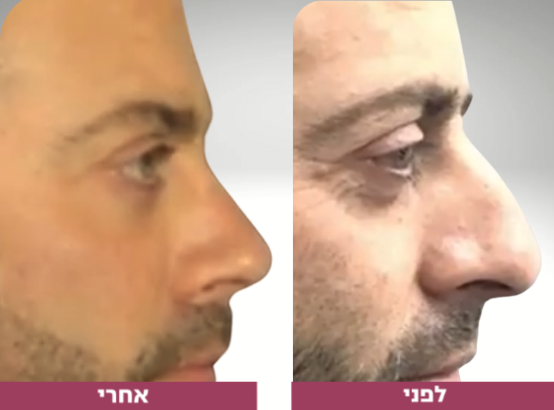 Pictures before and after