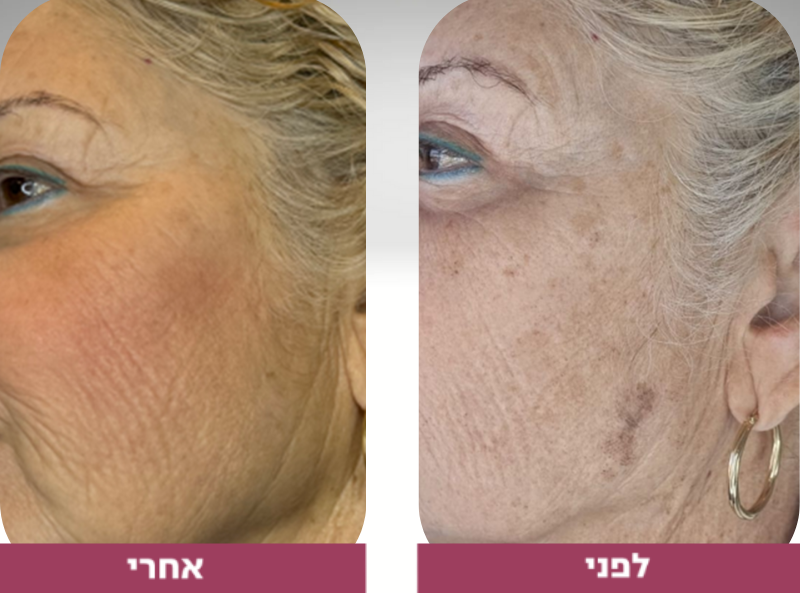 Pictures before and after