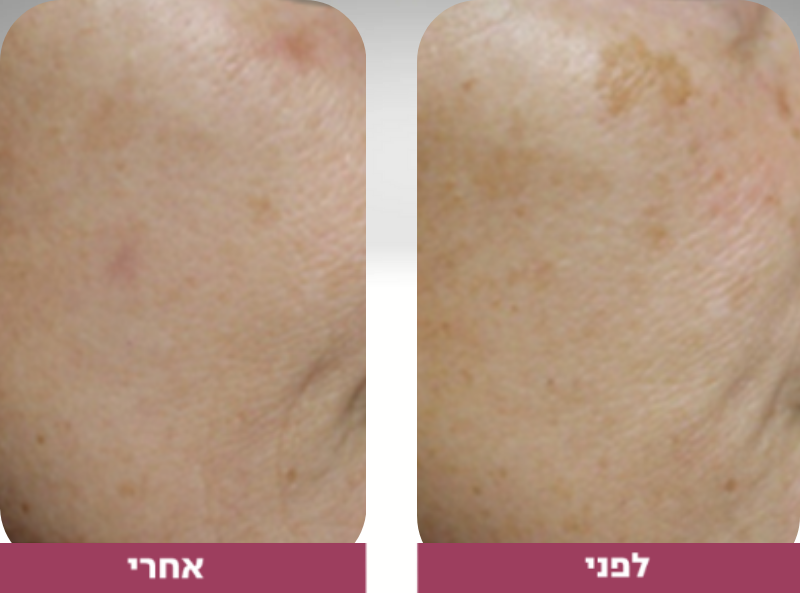 Pictures before and after