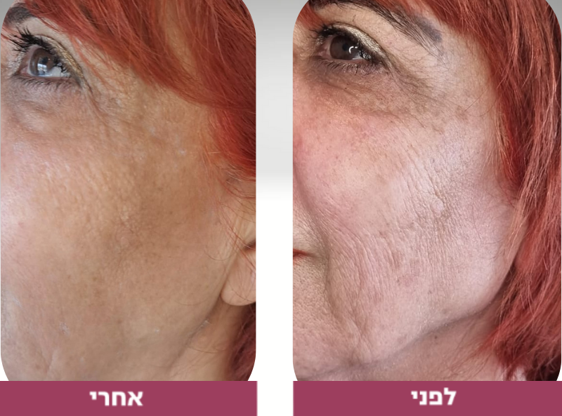 Pictures before and after