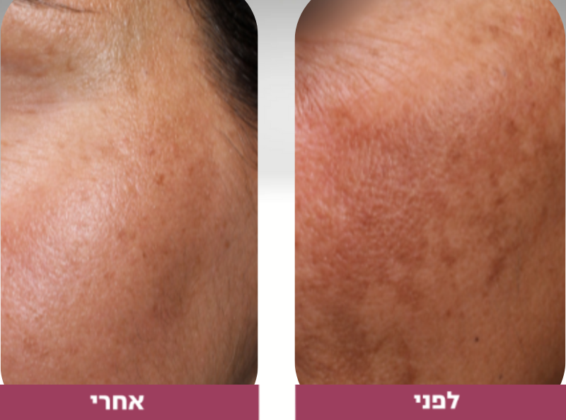 Pictures before and after