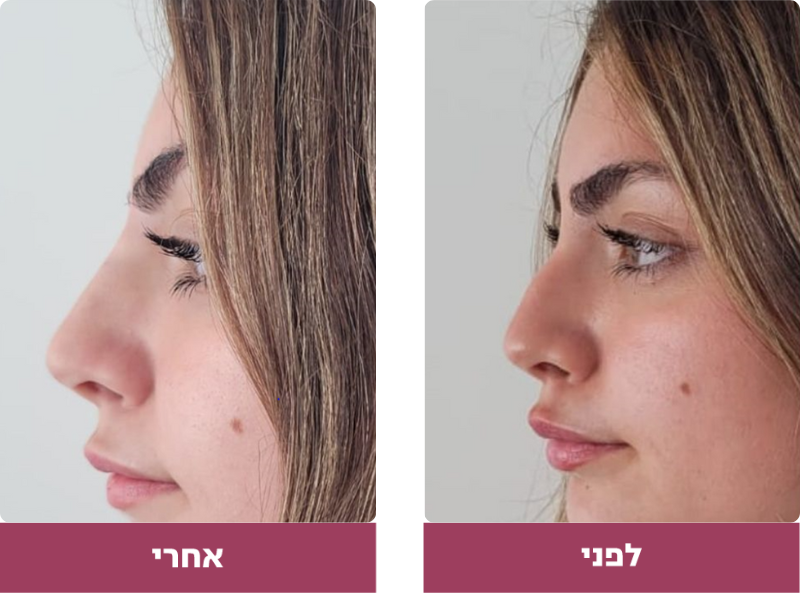 Pictures before and after