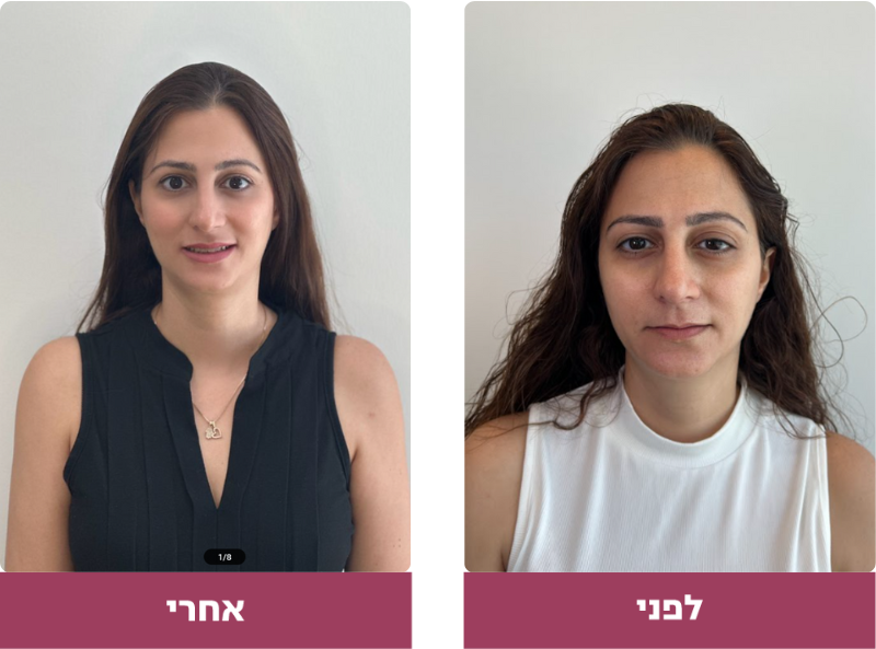 Pictures before and after