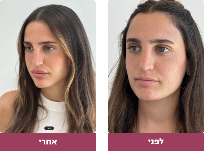 Pictures before and after