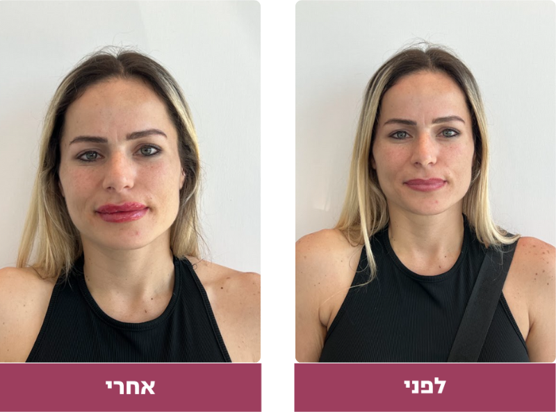 Pictures before and after